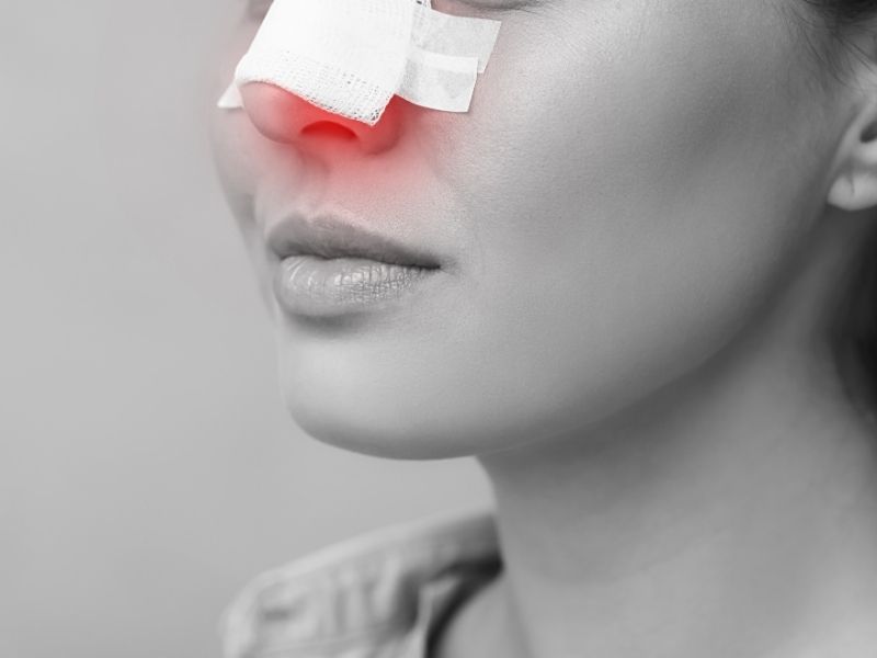 septorinoplastinin-riskleri-ve-komplikasyonlari