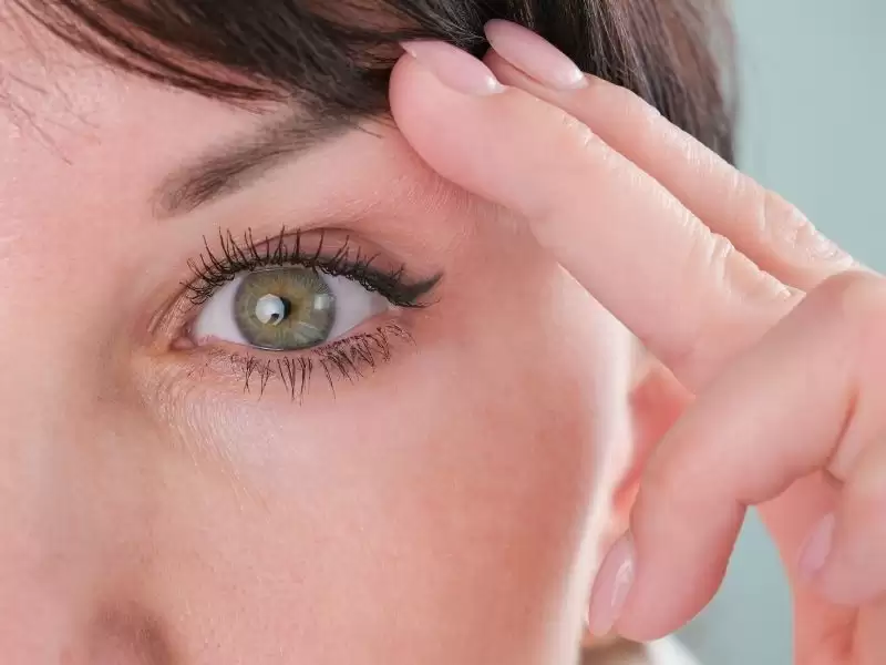 goz-kapagi-estetigi-genc-ve-dinc-bakislar-icin-bilmeniz-gerekenler