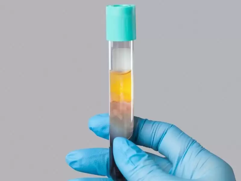 prp