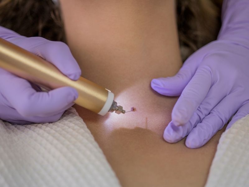 kimler-bu-isleme-uygundur