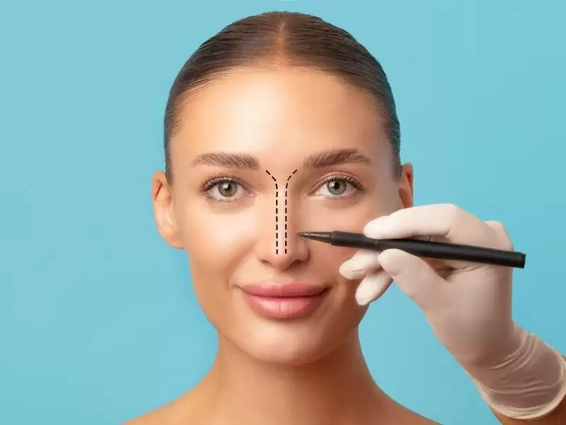 rinoplastide-gercekci-beklentiler-burnum-benim-istedigim-gibi-mi-olacak-doktorun-mu