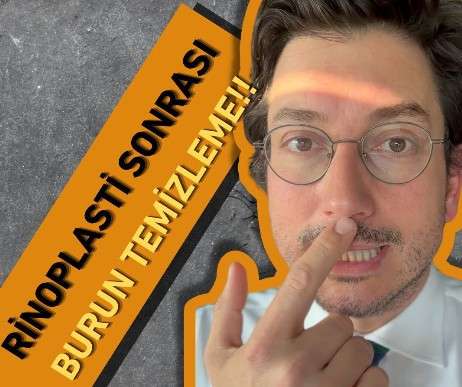 video,paylaşım,kameralı telefon,videofon,ücretsiz,yükleme