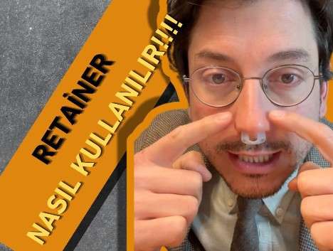 video,paylaşım,kameralı telefon,videofon,ücretsiz,yükleme