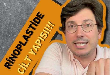 video,paylaşım,kameralı telefon,videofon,ücretsiz,yükleme