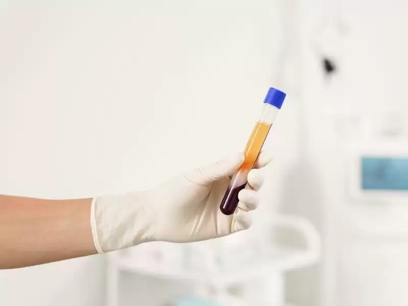 prp-nedir-prp-tedavisi-nasil-yapilir