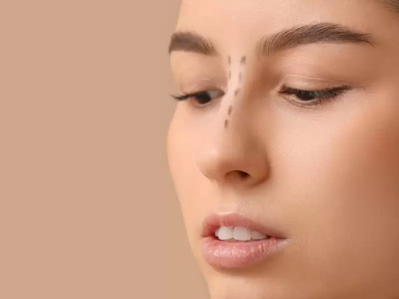 rinoplastide-gercekci-beklentiler-burnum-benim-istedigim-gibi-mi-olacak-doktorun-mu