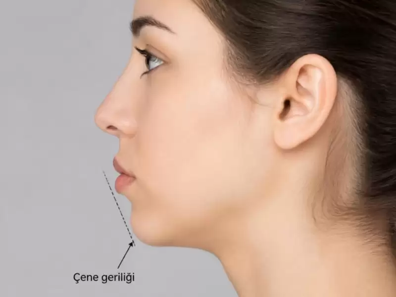 cene-geriligi